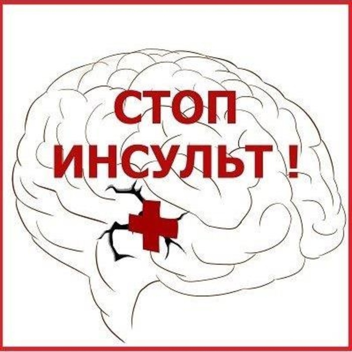 Кто имеет высокий риск инсульта?